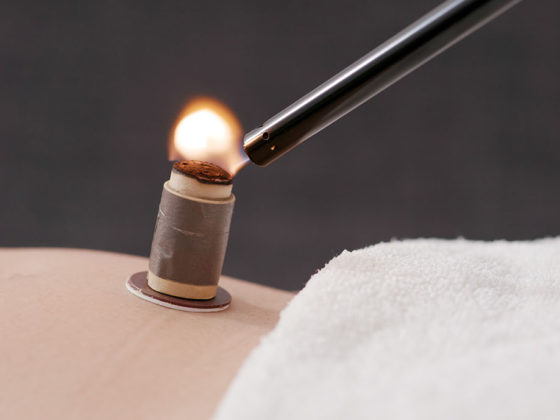 Μοξαθεραπεία