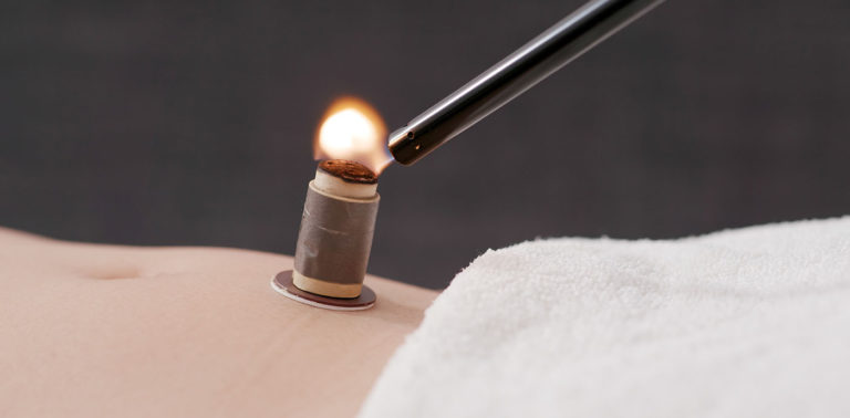 Μοξαθεραπεία